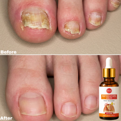 Tea Tree nail care solution